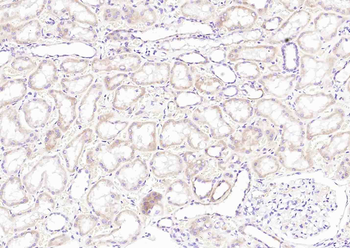 Prostatic acid phosphatase Mouse Monoclonal Antibody
