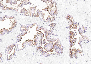 Prostatic acid phosphatase Mouse Monoclonal Antibody