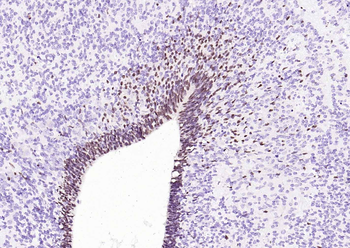 SOX2 Recombinant Rabbit Monoclonal Antibody