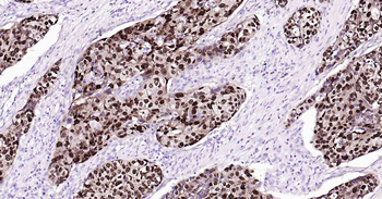 SOX2 Recombinant Rabbit Monoclonal Antibody