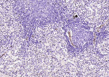 Nestin Mouse Monoclonal Antibody