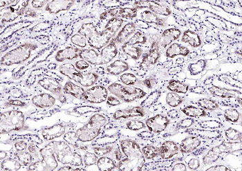 ACOT13 Rabbit Polyclonal Antibody