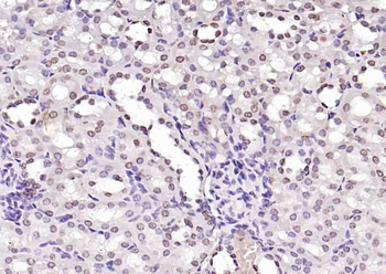 Cyclin G Rabbit Polyclonal Antibody