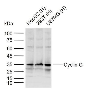 Cyclin G Rabbit Polyclonal Antibody