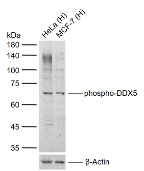 Phospho-DDX5 (Tyr593) Rabbit Polyclonal Antibody