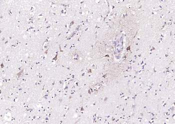 Cyclin G2 Rabbit Polyclonal Antibody