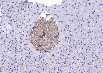 RPL5 Rabbit Polyclonal Antibody