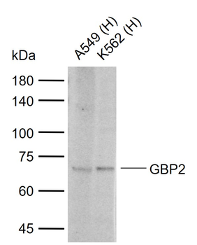 GBP2 Rabbit Polyclonal Antibody