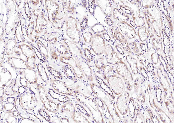 DGKH Rabbit Polyclonal Antibody