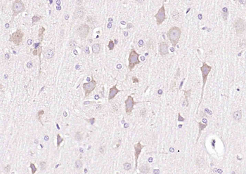 RHOJ Rabbit Polyclonal Antibody