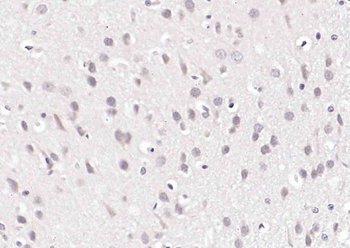 ZCWCC1 Rabbit Polyclonal Antibody