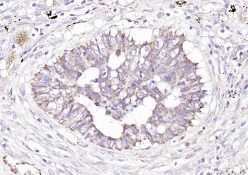 GGNBP2 Rabbit Polyclonal Antibody