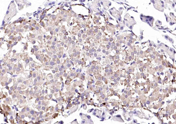 GGNBP2 Rabbit Polyclonal Antibody