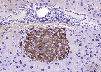 GGNBP2 Rabbit Polyclonal Antibody