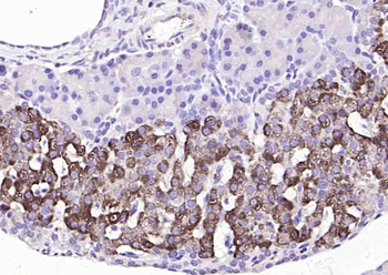 GGNBP2 Rabbit Polyclonal Antibody