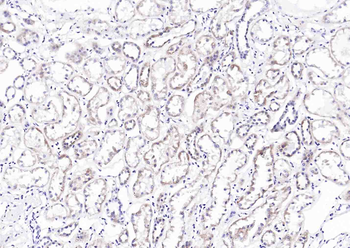 Phospho-LRP5 (Thr1492) Rabbit Polyclonal Antibody