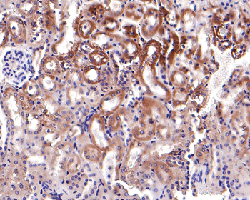 JAK1 Recombinant Rabbit Monoclonal Antibody