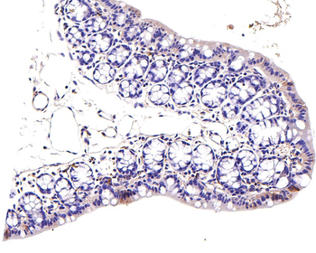 JAK1 Recombinant Rabbit Monoclonal Antibody
