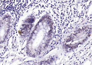 Prox1 Rabbit Polyclonal Antibody