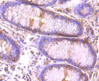 CLOCK Recombinant Rabbit Monoclonal Antibody