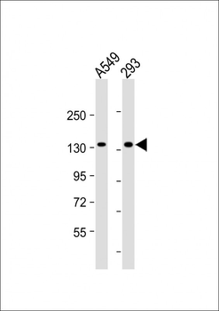 VEGFR3 Mouse Monoclonal Antibody