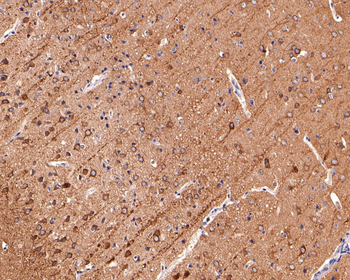 CD90/Thy-1 Recombinant Rabbit Monoclonal Antibody