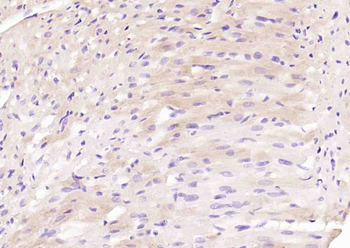 TMEM106B Rabbit Polyclonal Antibody