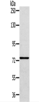 VPS53 Rabbit Polyclonal Antibody