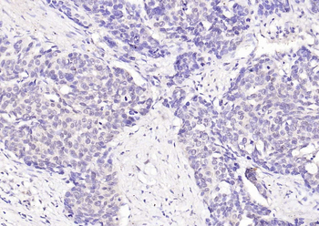 DSN1 Rabbit Polyclonal Antibody