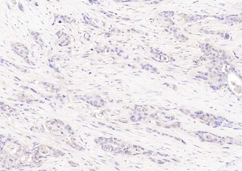 DSN1 Rabbit Polyclonal Antibody