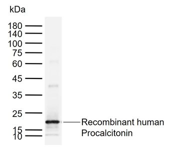 Procalcitonin (PCT) Mouse Monoclonal Antibody