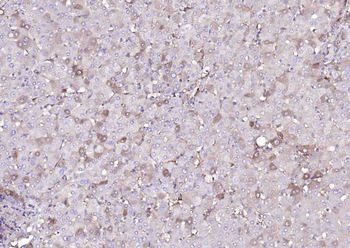PTH1R Rabbit Polyclonal Antibody