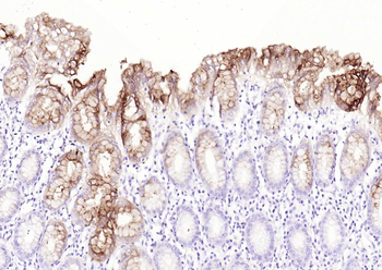 CEACAM5 Mouse Monoclonal Antibody