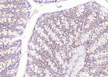 NME1/NM23A Rabbit Polyclonal Antibody