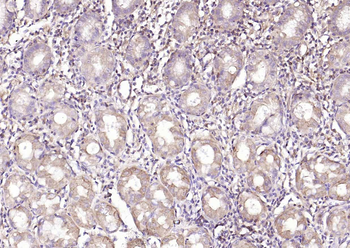TFF1 Rabbit Polyclonal Antibody