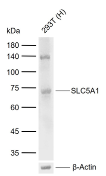 SLC5A1 Rabbit Polyclonal Antibody