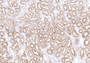 Villin Mouse Monoclonal Antibody