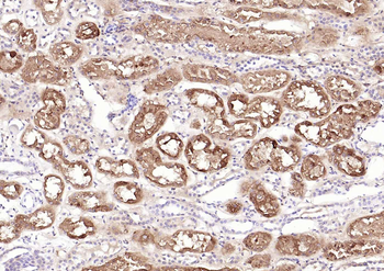 Villin Mouse Monoclonal Antibody