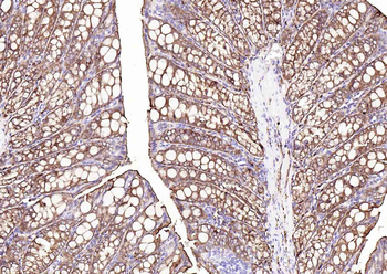 Villin Mouse Monoclonal Antibody