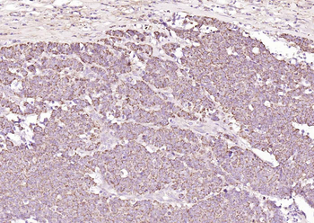 TRPM8 Rabbit Polyclonal Antibody