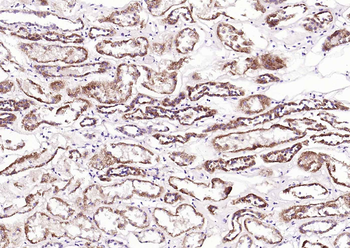 TRPM8 Rabbit Polyclonal Antibody