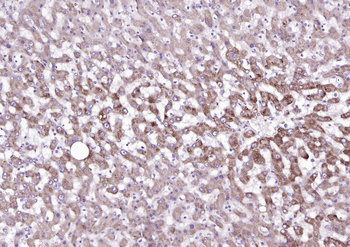 TRPM8 Rabbit Polyclonal Antibody