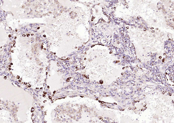TRPM8 Rabbit Polyclonal Antibody
