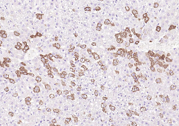 TRPM8 Rabbit Polyclonal Antibody