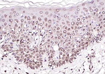 ALPK3 Rabbit Polyclonal Antibody