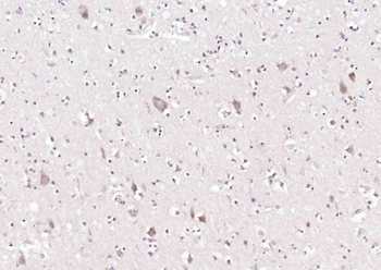 FAM134B Rabbit Polyclonal Antibody