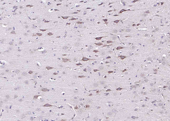 SLC25A23 Rabbit Polyclonal Antibody