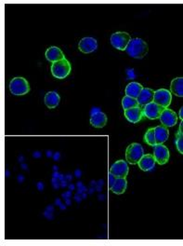 NGFR/p75NTR Recombinant Rabbit Monoclonal Antibody