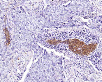 NGFR/p75NTR Recombinant Rabbit Monoclonal Antibody