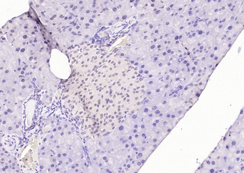HNF1A Rabbit Polyclonal Antibody